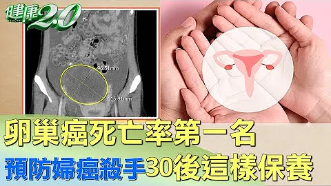 卵巢癌死亡率第一名 预防妇癌杀手30后这样保养 健康2.0 - 天天要闻