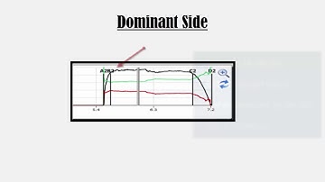 Evaluating Closures with T-Scan: Part 3