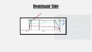 Evaluating Closures with T-Scan: Part 3