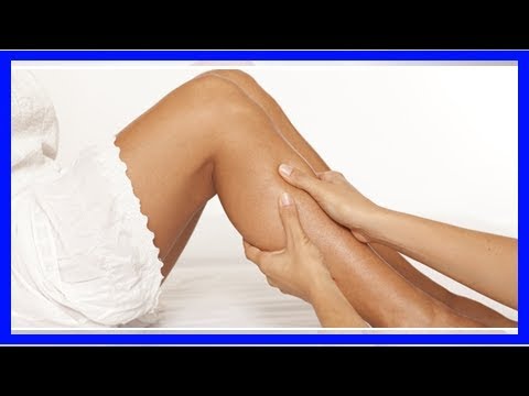 10 Cara Mudah Mengatasi Masalah Varises