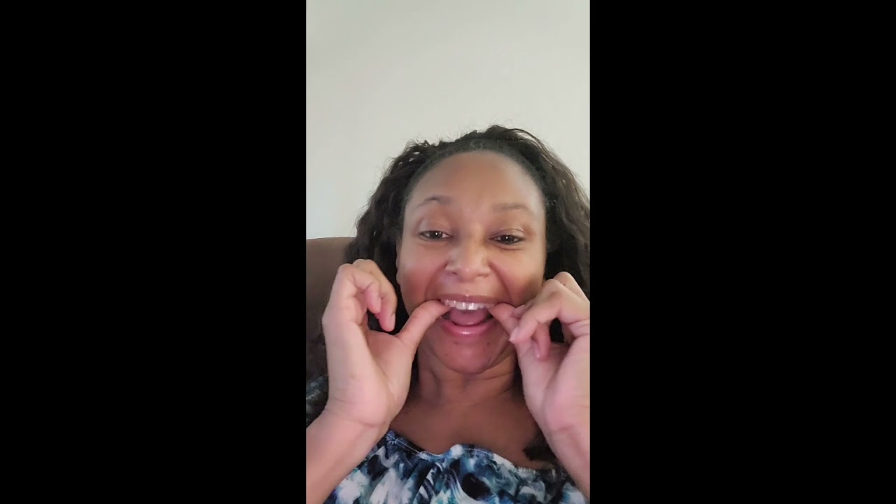 My Invisalign Braces Experience Week 3 YouTube