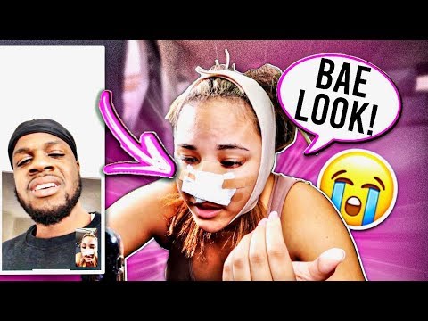 telling-my-boyfriend-i-got-a-nose-job-to-see-how-he-reacts