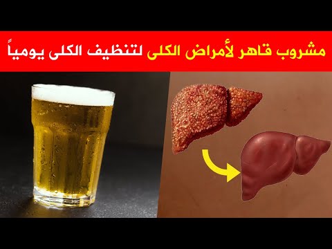 مشروب قاهر لأمراض الكلى لتنظيف الكلى يومياً 🙂 قل وداعا لحصوات الكلى أوالفشل الكلوي بإرادة الله