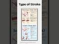 A stroke refers to the interruption of blood flow to the brain, leading to cell damage!