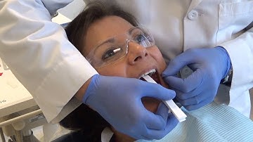 bite registration windows media