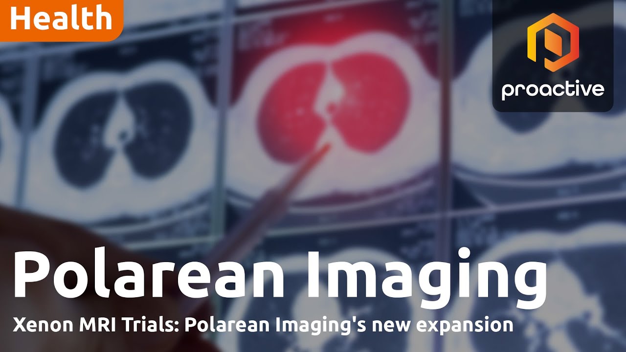 Polarean Imaging chief business officer on potential of Xenon MRI pharma trials