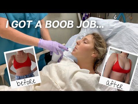 I GOT A BOOB JOB! my experience, cost, sizing & 1 month update