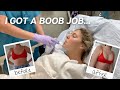 I GOT A BOOB JOB! my experience, cost, sizing & 1 month update