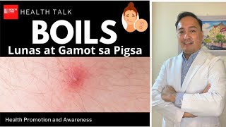 Boils (Pigsa): Causes, Symptoms, Treatment and Prevention