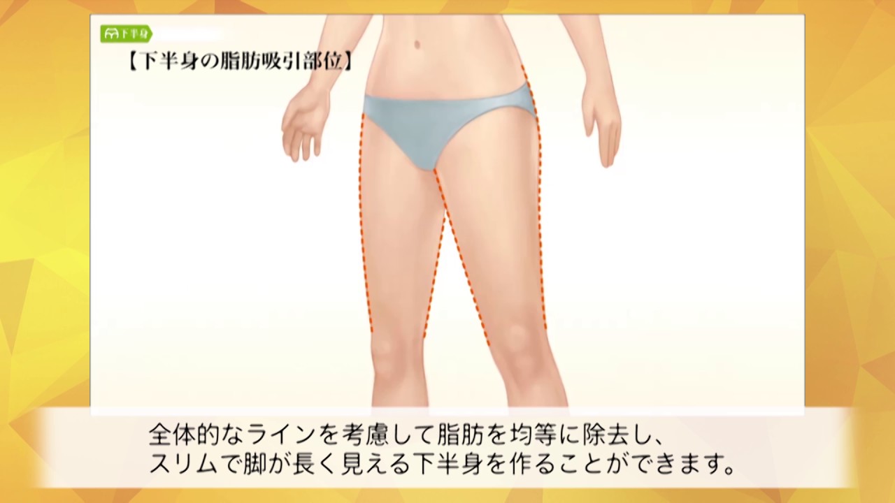 医師監修 下半身の脂肪吸引 特徴 美容整形は東京美容外科