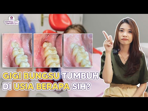 JADI TAU! TERNYATA INI USIA TUMBUH GIGI BUNGSU