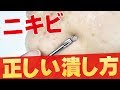 【美容】正しいニキビの潰し方＆ニキビを潰しちゃダメは嘘。