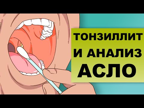 АНАЛИЗ АСЛО ПРИ ТОНЗИЛЛИТЕ