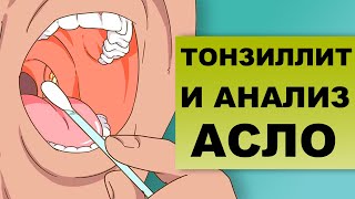 АНАЛИЗ АСЛО ПРИ ТОНЗИЛЛИТЕ