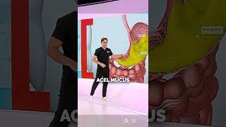 Ulcerul Gastric Cauze