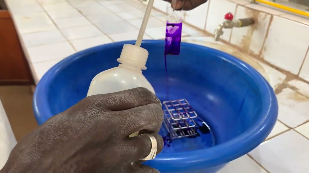 Technique du Prélèvement vaginal détaillée ( P V )