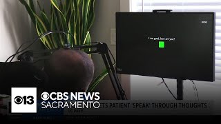 New UC Davis tech lets ALS patient speak through thoughts