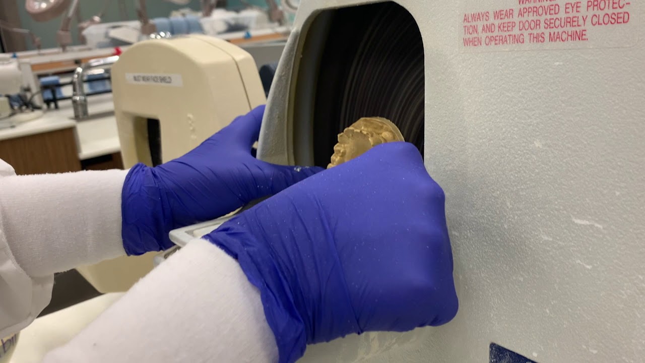 Trimming Models for Whitening Trays YouTube