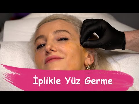 İplikle Yüz Germe