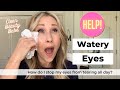 Watery Eyes: Help!!! How do you stop your eyes from constantly tearing?