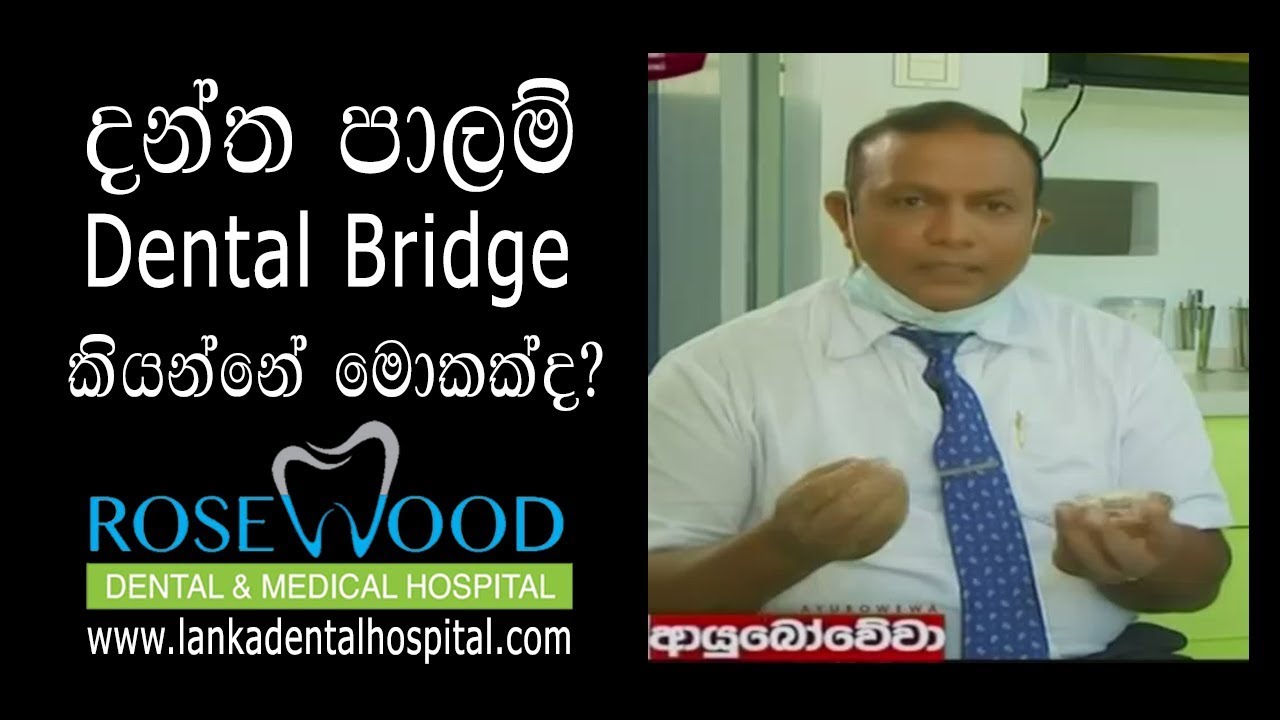 දන්ත පාලම් | Dental Bridge කියන්නේ මොකක්ද?