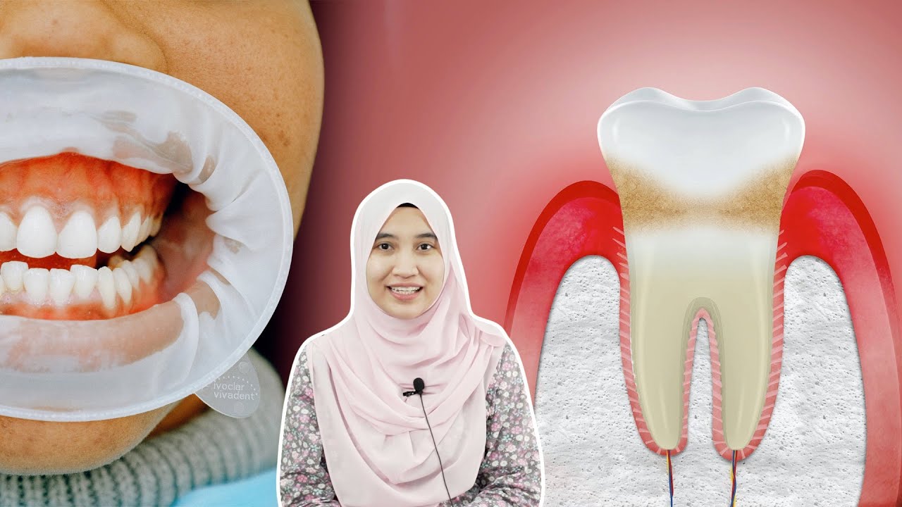 Gusi Berdarah: Patut ke Klinik Biasa atau Klinik Gigi?