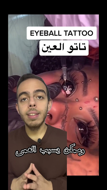 تاتو العين (وشم العين) #طب #medicine #shorts