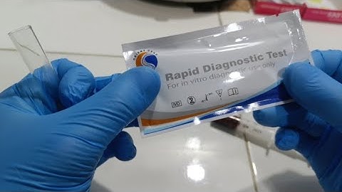 Hepatitis B rapid test(HBS) Hep C testing: fret No more with the iCare a the Hep C test kit