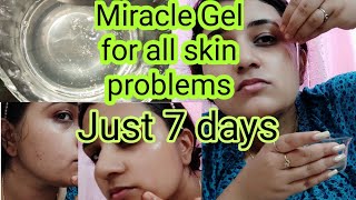 Apply this gel and see the miracle|| For all skin problems||Face gel for flawless skin