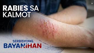 RABIES sa kalmot: Kahit kalmot lang, pwede kang magka-rabies