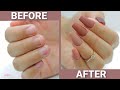 💖  Fix your SHORT BITTEN Nails with Acrylic😍 💅🏼  | Thanksgiving Edition 🍁