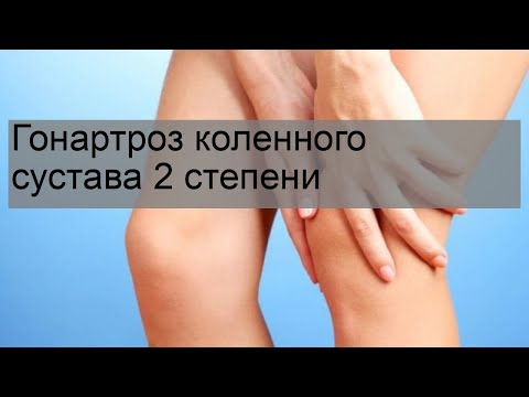 Гонартроз коленного сустава 2 степени