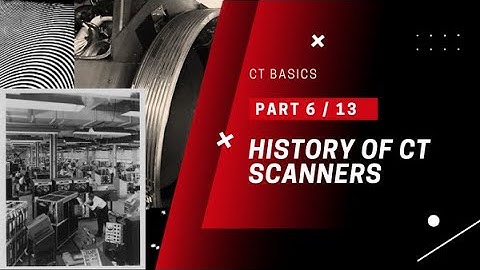 History of CT Scanners