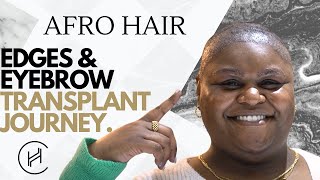 Brandi's Hair and Eyebrow Transplant - Journey Starts From Florida to Istanbul #afrohair #hevaclinic