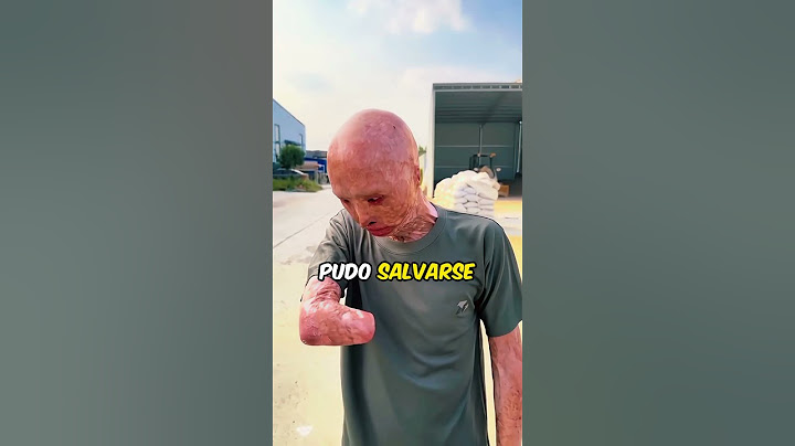 He Saved His Girlfriend But At What Price😲🥺