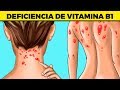 11 señales que tu cuerpo necesita más vitamina b1 o tiamina ► SIGNOS REVELADORES