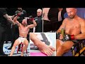UFC 321 SHOCKER: Ludovit Klein Wins Despite Brutal Broken Ankle!