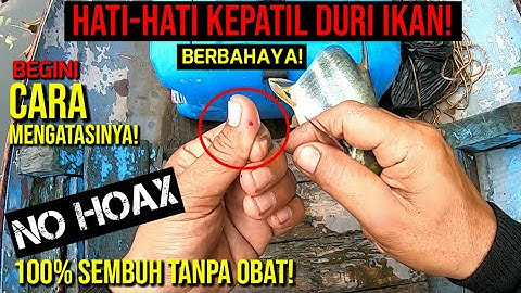 KENA PATIL IKAN?? JANGAN PANIK, BEGINI CARA MENYEMBUHKAN NYA!! || 10 MENIT SEMBUH TANPA OBAT