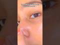 say goodbye to blackheads 🤩🖐🏻 #song #love #ytshorts #blackheads #scrub #tomato #viral #hack #fyp