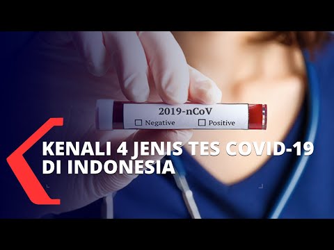 Video: Kementerian Kesehatan Menghitung Berapa Banyak Tes Untuk COVID-19 Yang Keliru