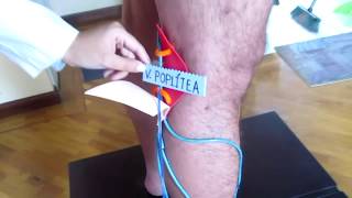 Anatomía venosa superficial pierna