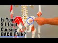 Is Your S.I Causing Your Back Pain? A Simple Finger Test (Sacro-Iliac)