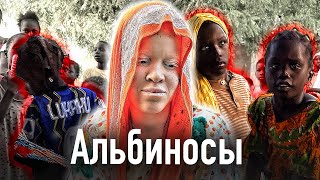Как альбиносы в Африке становятся изгоями, жертвами колдунов и изнасилований / Сенегал