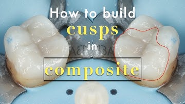 How to build a cusp in composite