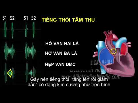 Video: Cách điều Trị Tiếng Thổi Tim ở Trẻ Em