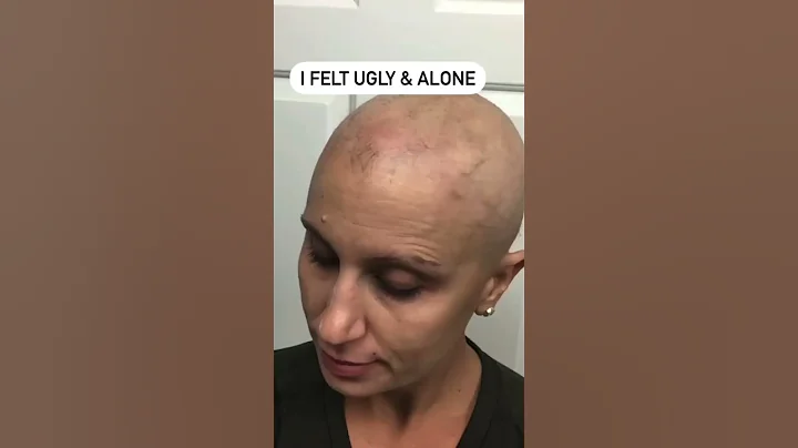 Video: Watch Mirna Alopecia's Incredible Transformation with Follea Wig #wigs #wigsforalopecia