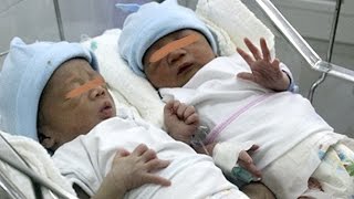 Lần đầu tiên phát hiện cặp song sinh khác cha ở Việt Nam - TIN TỨC 24H TV