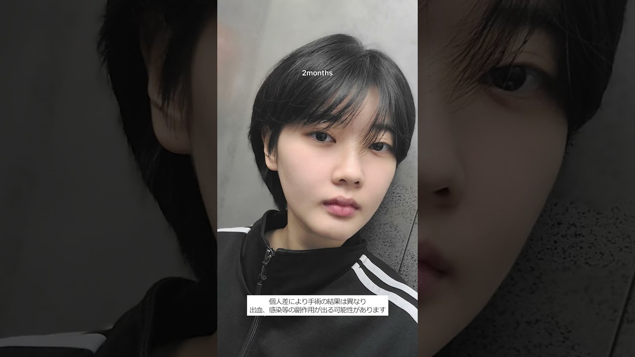 등록한썸네일