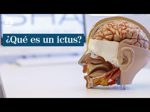 Vídeo: Què és l'ictus d'hemiplegia?