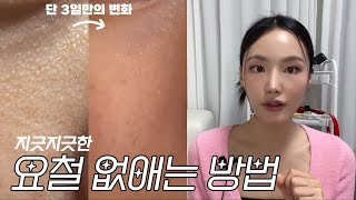 sub)광고❌ 지긋지긋한 요철 없애는 방법(+찐후기영상, 루틴소개, 제품추천까지 다 담았뜨아💚🧡)